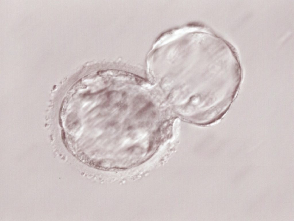 D18/BT0　凍結胚盤胞移植しました